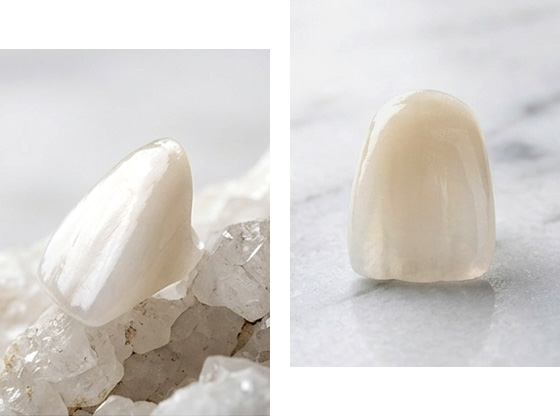 라미네이트 사진