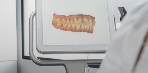 치아 분석 사진