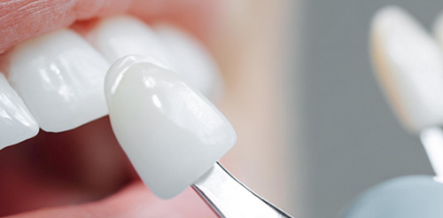 라미네이트 밀착 사진